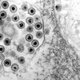 Illustration for article titled Tips Cara Mengatasi Penyakit Herpes